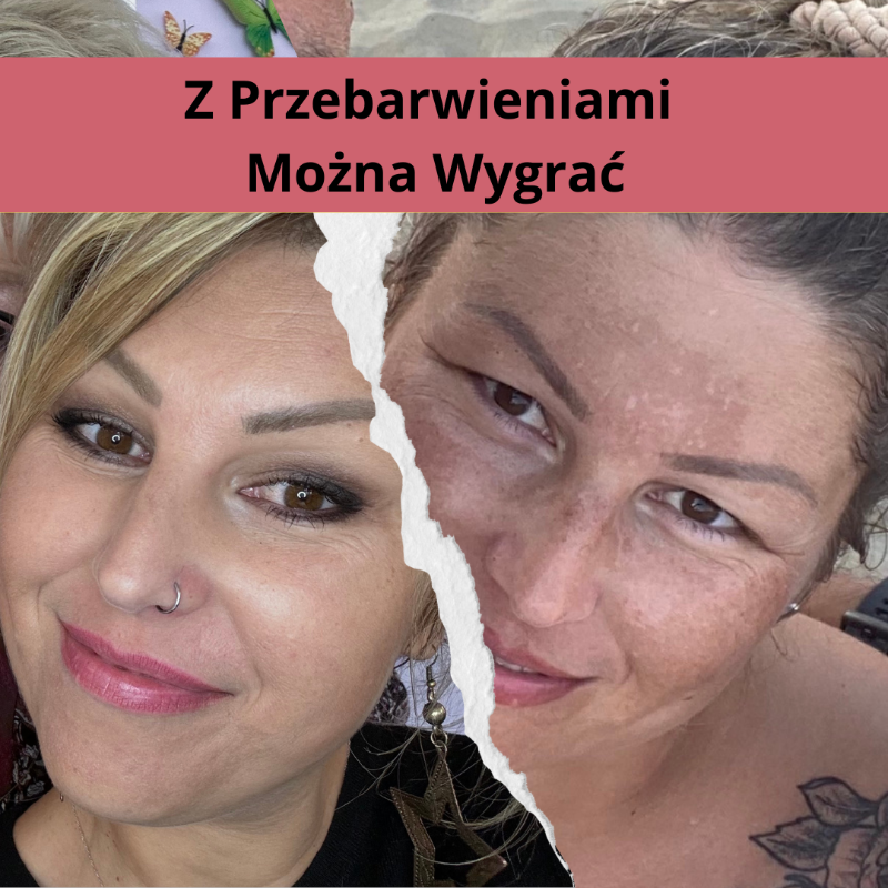 Przebarwienia twarzy przed i po